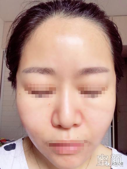 案例图片