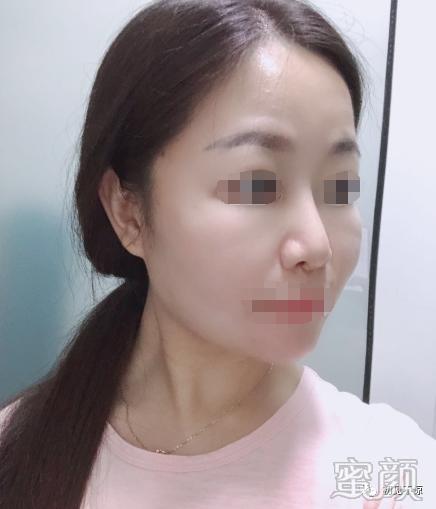 案例图片