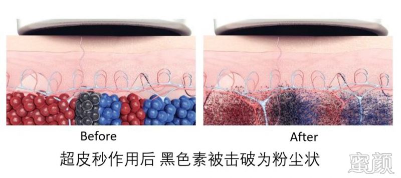 https://img.yiyiaimei.com/mnt/timg/200328/11154RN0-3.jpg