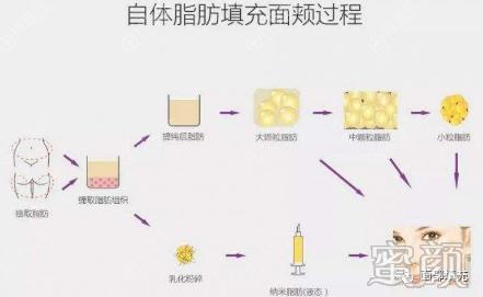 https://img.yiyiaimei.com/mnt/timg/200328/13322LU6-2.jpg