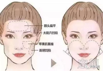 https://img.yiyiaimei.com/mnt/timg/200328/13322U016-3.jpg