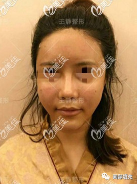 https://img.yiyiaimei.com/mnt/timg/200328/1333443546-1.jpg