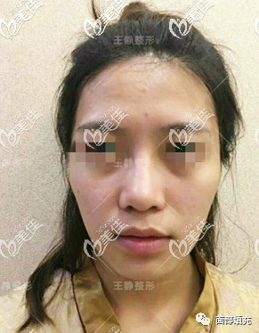 https://img.yiyiaimei.com/mnt/timg/200328/1333443554-0.jpg