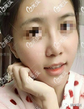https://img.yiyiaimei.com/mnt/timg/200328/1333455X5-3.jpg