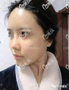 https://img.yiyiaimei.com/mnt/timg/200328/1333456318-2.jpg