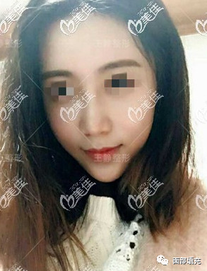 https://img.yiyiaimei.com/mnt/timg/200328/13334A295-4.jpg