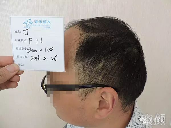 https://img.yiyiaimei.com/mnt/timg/200328/1342023X6-1.jpg