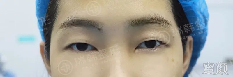 案例图片