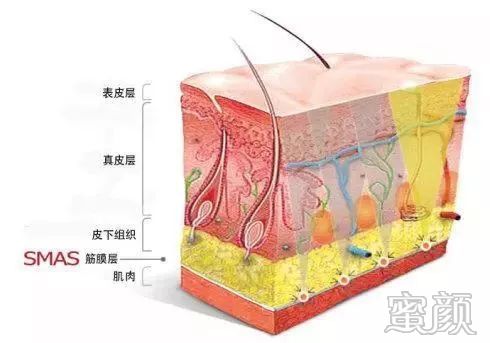 案例图片