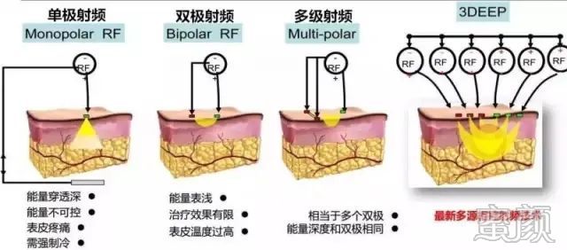 案例图片