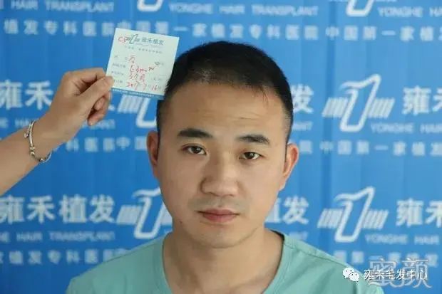 https://img.yiyiaimei.com/mnt/timg/200328/14093J448-11.jpg