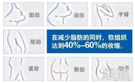案例图片