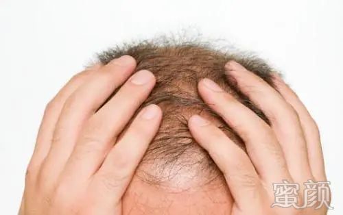 https://img.yiyiaimei.com/mnt/timg/200328/1420145262-0.jpg