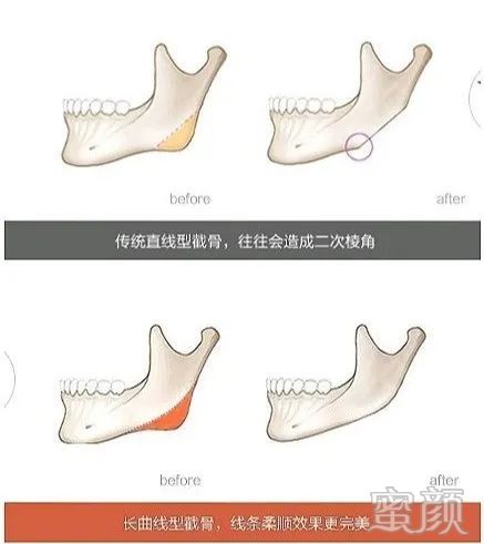https://img.yiyiaimei.com/mnt/timg/200328/1426401Y0-2.jpg