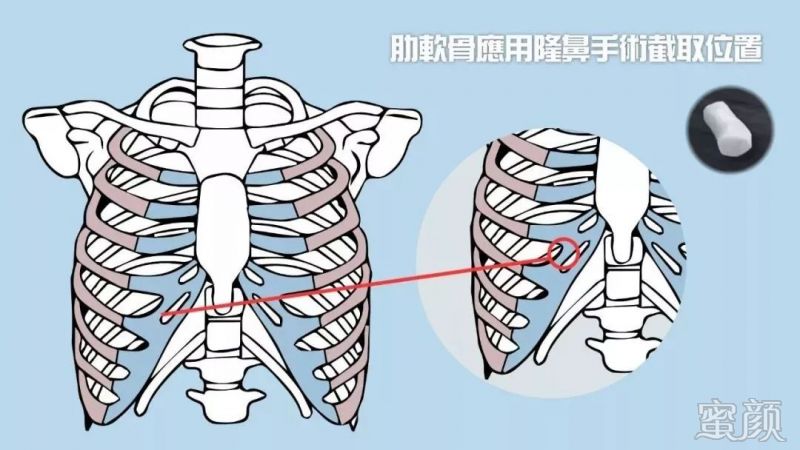 案例图片