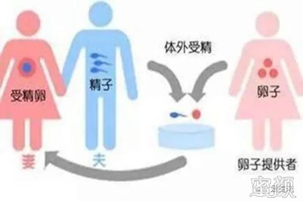 https://img.yiyiaimei.com/mnt/timg/200329/14530a022-0.jpg 案例图片