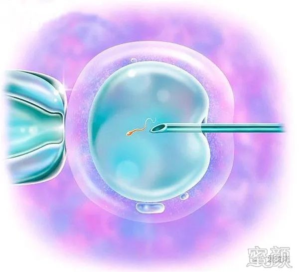 https://img.yiyiaimei.com/mnt/timg/200329/1453103Y3-2.jpg 案例图片