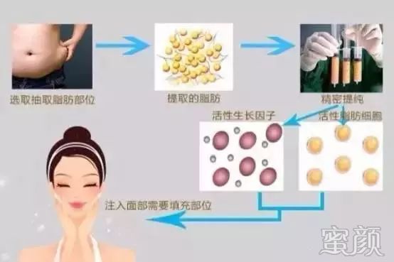 https://img.yiyiaimei.com/mnt/timg/200329/152J03I5-4.jpg