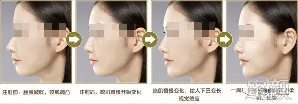 案例图片