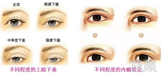 https://img.yiyiaimei.com/mnt/timg/200330/131H96409-3.jpg