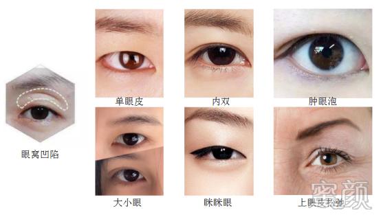 https://img.yiyiaimei.com/mnt/timg/200330/131HKJ1-2.jpg