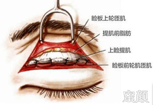 https://img.yiyiaimei.com/mnt/timg/200330/131I14c3-6.jpg
