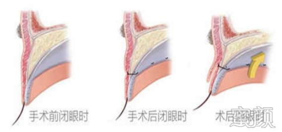 https://img.yiyiaimei.com/mnt/timg/200330/131I2N46-9.jpg