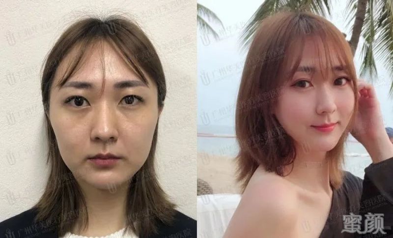 案例图片