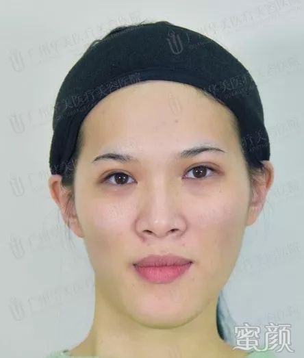 案例图片