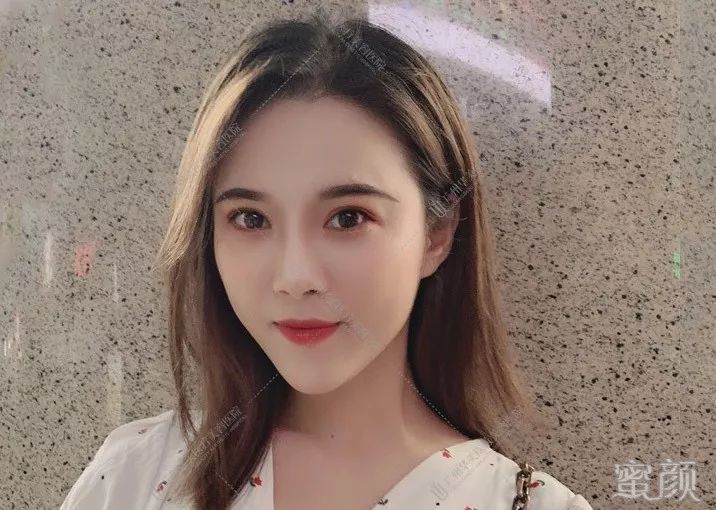 案例图片