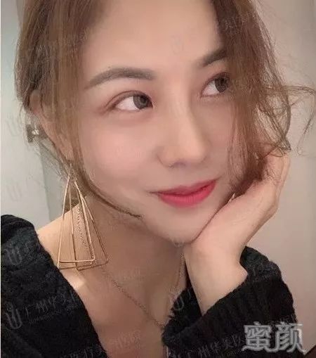 案例图片