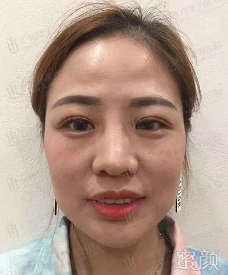 案例图片