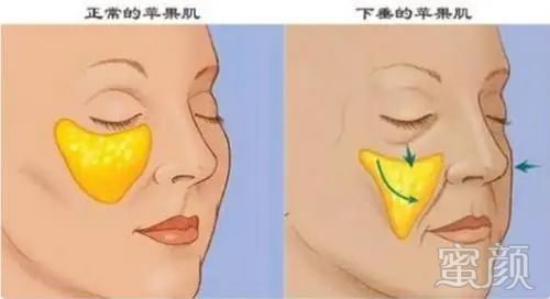 https://img.yiyiaimei.com/mnt/timg/200330/14004920E-7.jpg