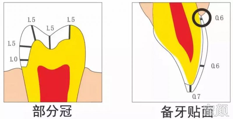 案例图片