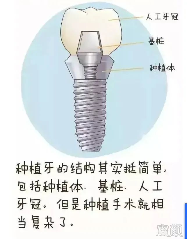 案例图片