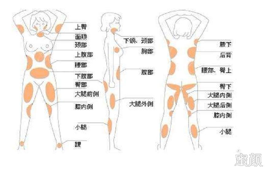 案例图片