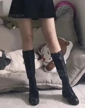 案例图片