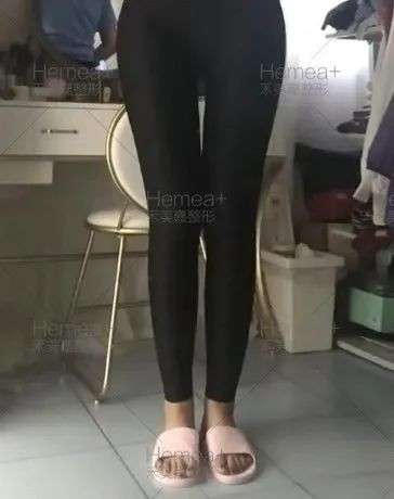 案例图片