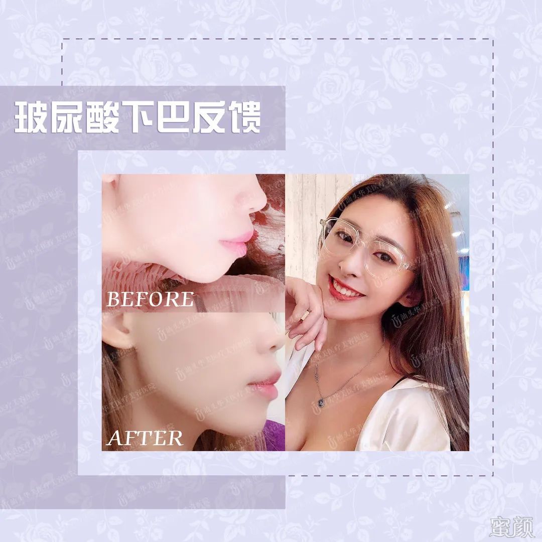 https://img.yiyiaimei.com/mnt/timg/200408/1345594160-7.jpg 案例图片