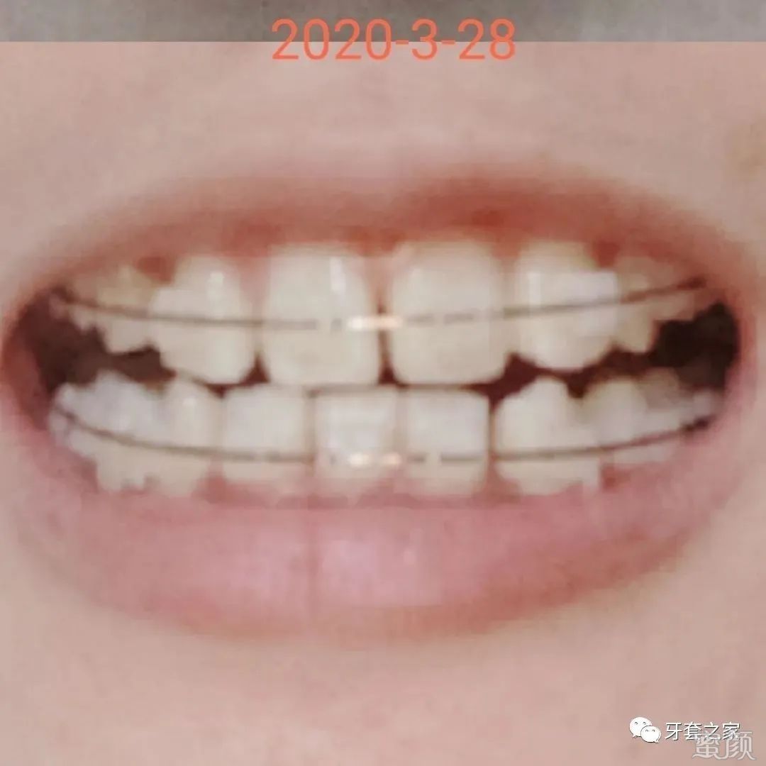 https://img.yiyiaimei.com/mnt/timg/200408/1352345504-4.jpg 案例图片