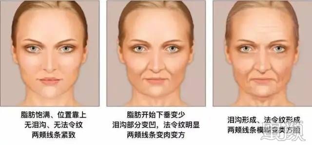 案例图片