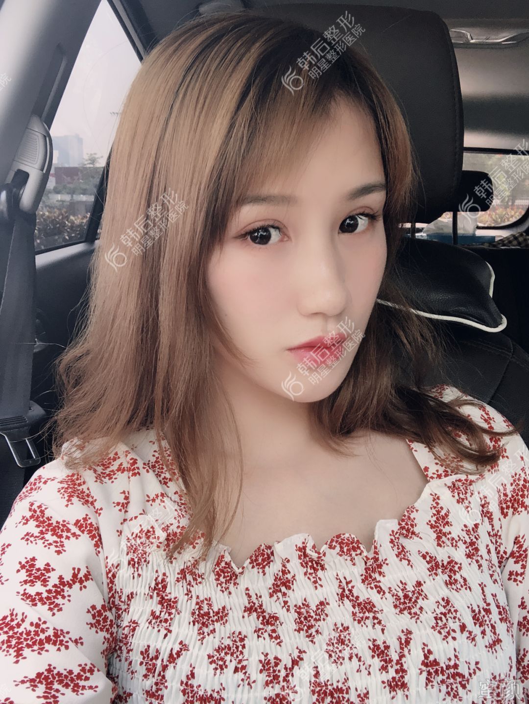 案例图片