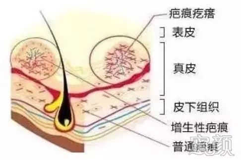 案例图片