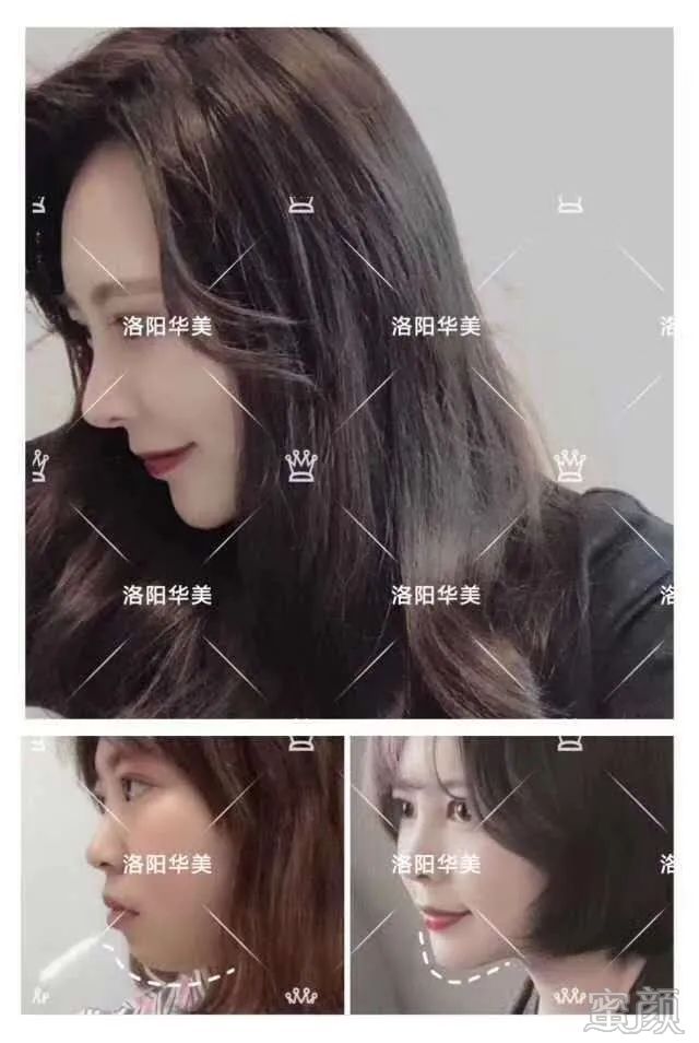 案例图片