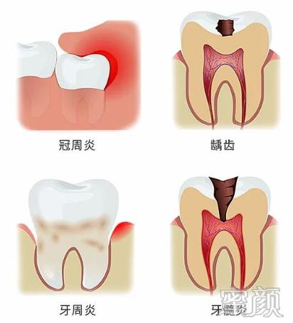 案例图片