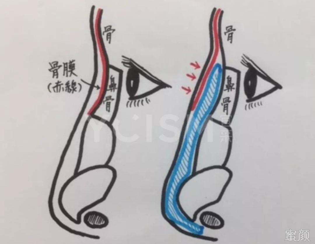 案例图片