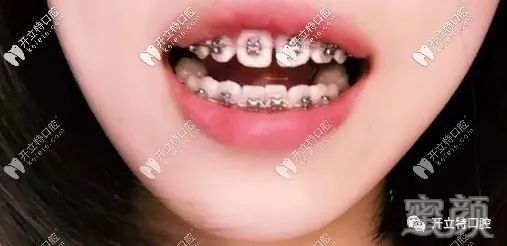 https://img.yiyiaimei.com/mnt/timg/200409/143ILP6-1.jpg
