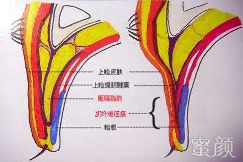 案例图片