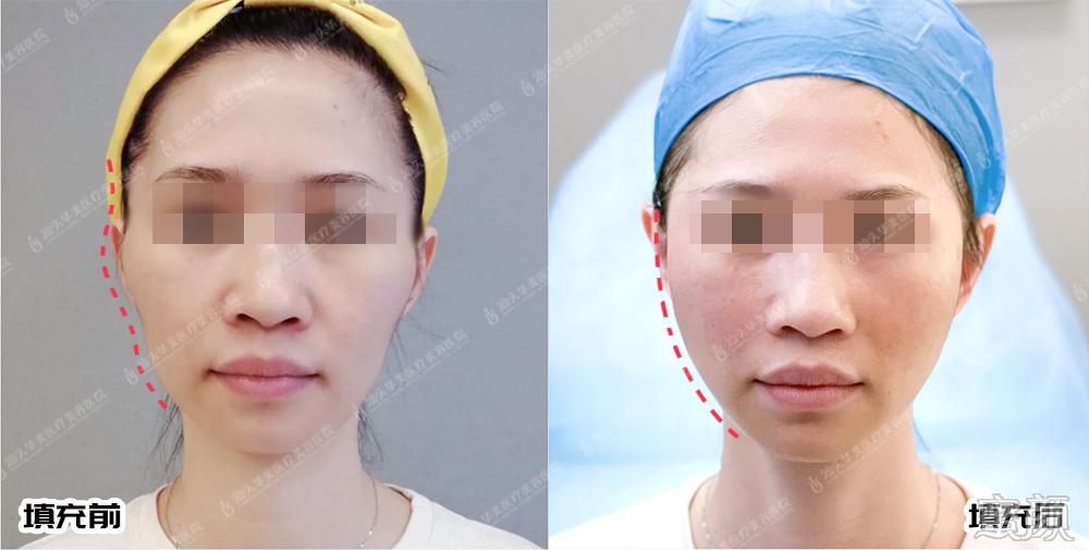 https://img.yiyiaimei.com/mnt/timg/200409/144334C03-1.jpg