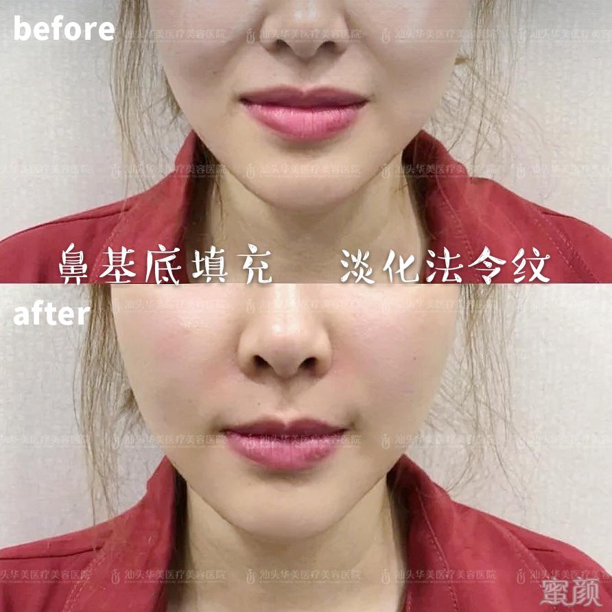 https://img.yiyiaimei.com/mnt/timg/200409/14434342P-3.jpg